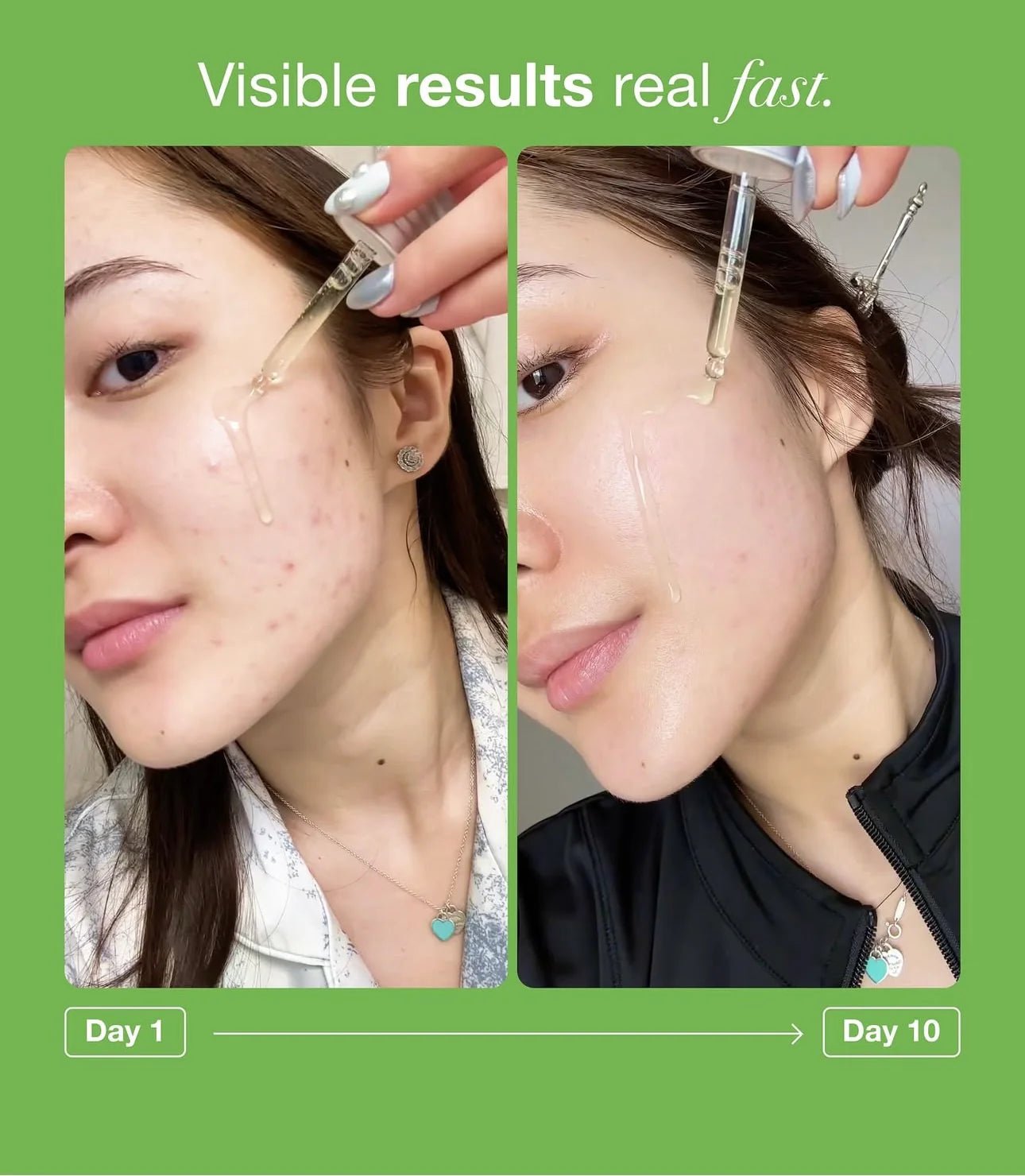 ANUA - AZELAIC ACID 10 HYALURON REDNESS SOOTHIING SERUM - MeStore - Anua