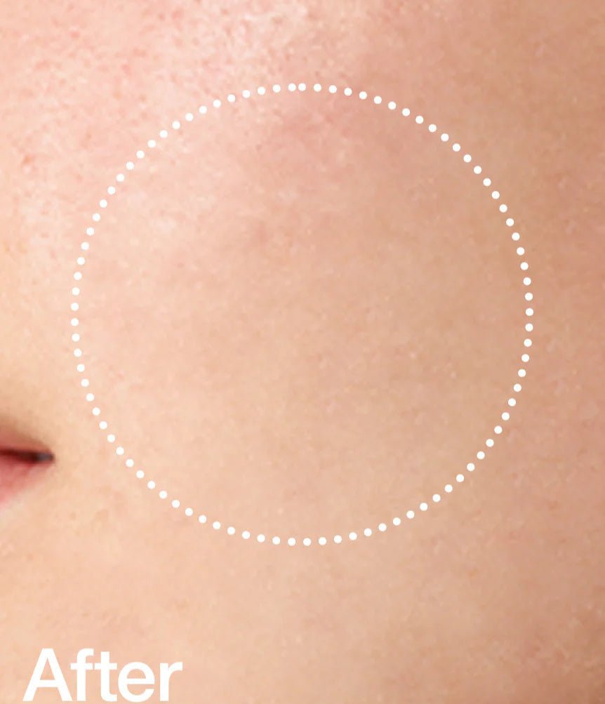 Anua Bha Exfoliating Toner - MeStore - Anua