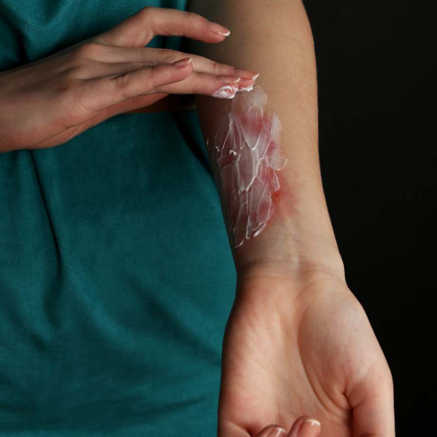 Ointments - MeStore