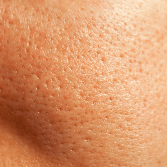 Skin Pores - MeStore