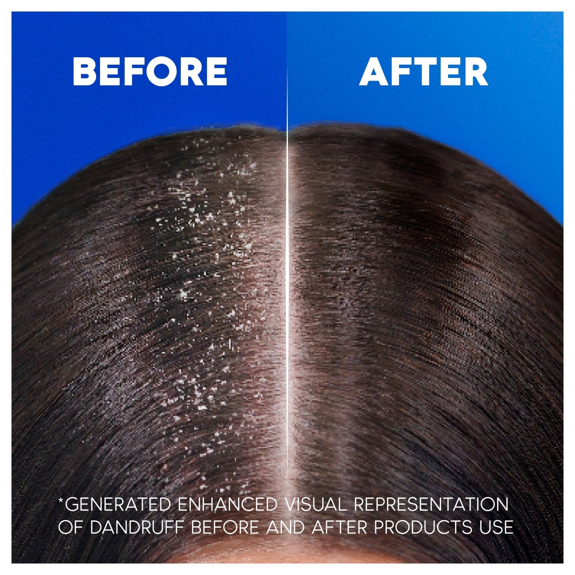 Head And Shoulders 250Ml Smooth And Silky - MeStore - Head & Shoulders
