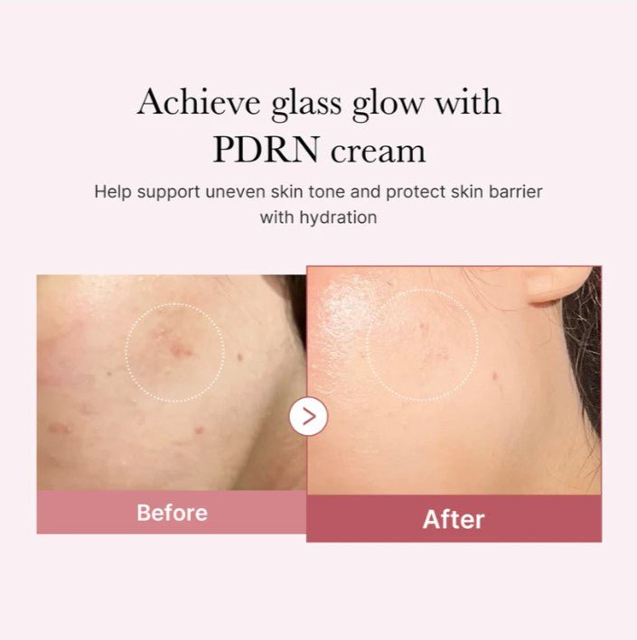 MEDICUBE - PDRN PINK HYALURONIC MOISTURIZING CREAM 50ML - MeStore - MEDICUBE