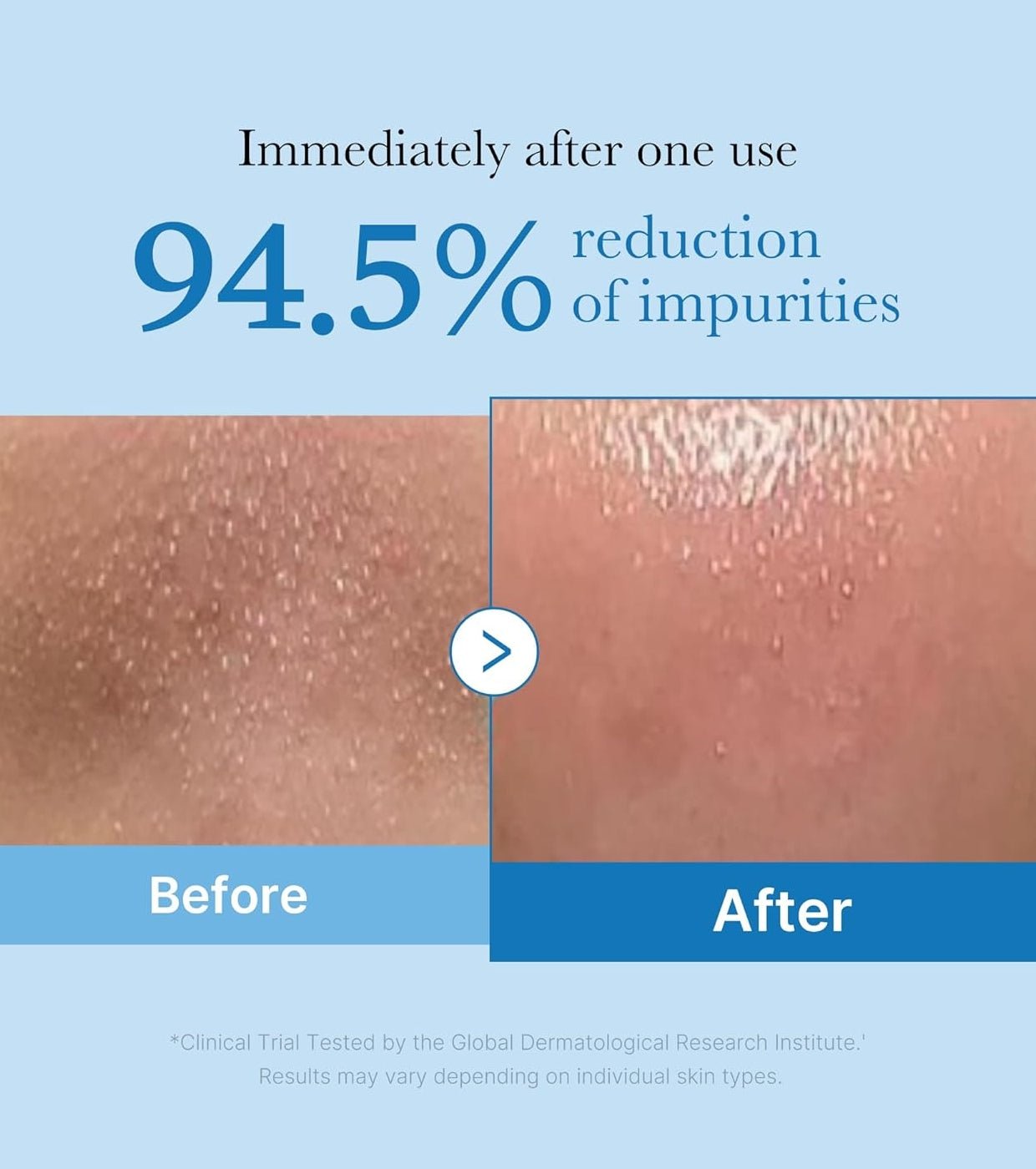 MEDICUBE - ZERO PORE BLACKHEAD DEEP CLEANSING OIL 205 Ml - MeStore - MEDICUBE
